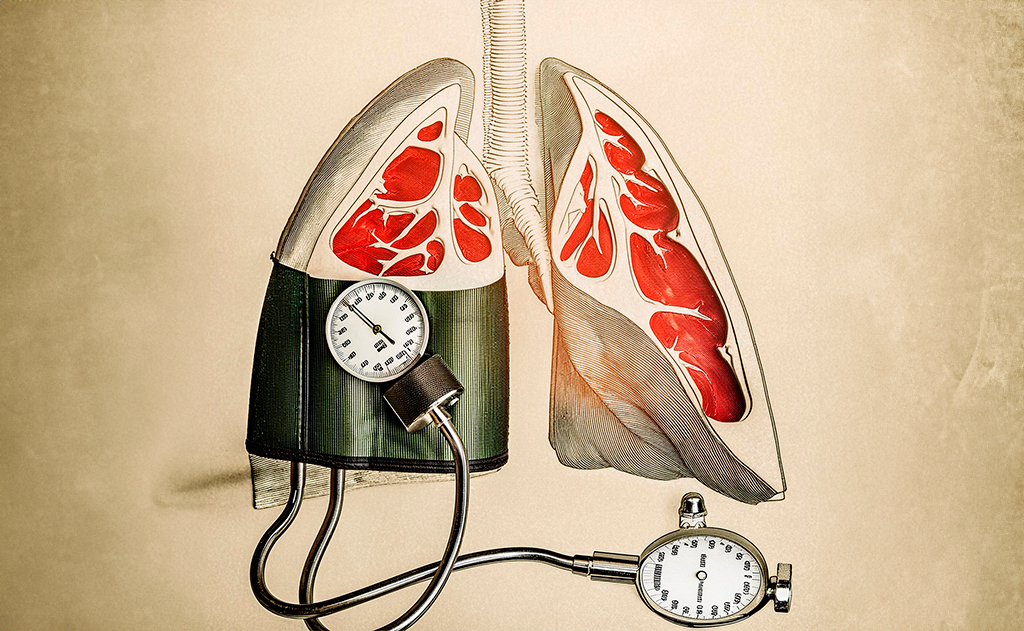 Efeitos do TMI em pacientes com Hipertensão da artéria pulmonar